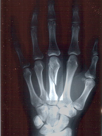 radiology-medical-malpractice