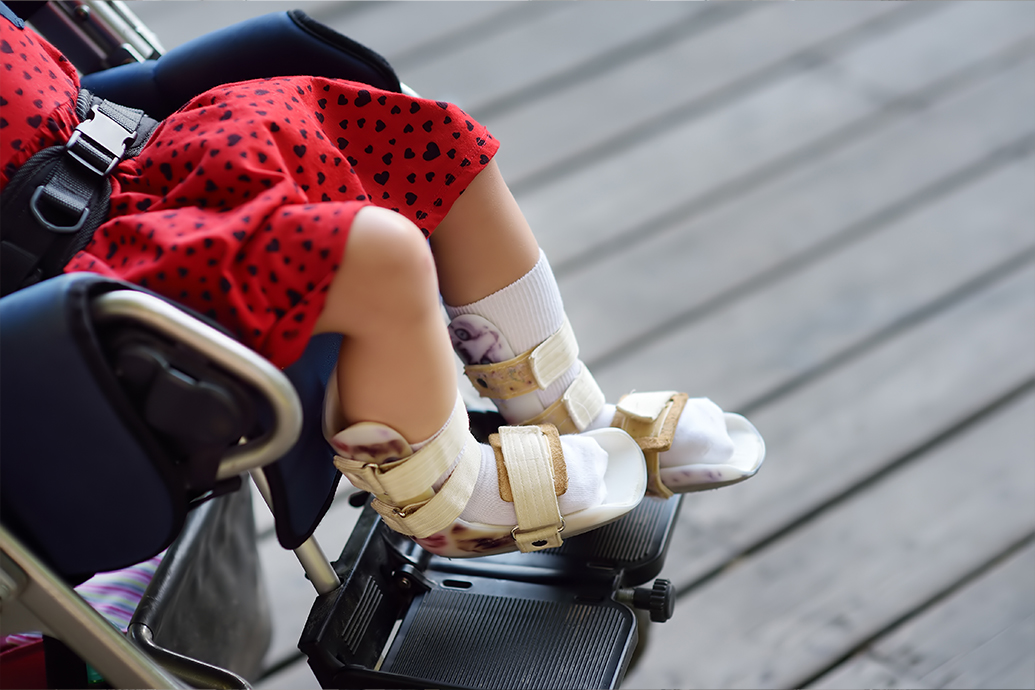 A young child in a stroller wears leg braces as a demonstration of developmental delays and cerebral palsy in babies.