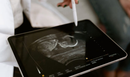 A doctor points to an ultrasound image on an iPad to discuss the injuries that will later lead to a birth defect lawsuit