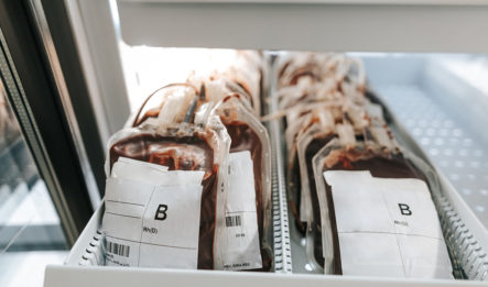 preparing blood bags for an organ transplant surgery